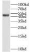 BEN Domain Containing 5 antibody, FNab00863, FineTest, Western Blot image 