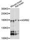 Adhesion G Protein-Coupled Receptor B2 antibody, LS-C747487, Lifespan Biosciences, Western Blot image 