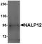 NACHT, LRR and PYD domains-containing protein 12 antibody, A02124, Boster Biological Technology, Western Blot image 