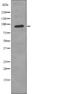Fibroblast Growth Factor Receptor 3 antibody, PA5-64798, Invitrogen Antibodies, Western Blot image 