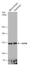Ubiquitin carboxyl-terminal hydrolase 48 antibody, GTX133346, GeneTex, Western Blot image 