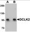 Doublecortin Like Kinase 2 antibody, orb89862, Biorbyt, Western Blot image 