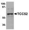 DDB1 And CUL4 Associated Factor 12 antibody, orb75403, Biorbyt, Western Blot image 