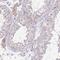 Hydroxysteroid 17-Beta Dehydrogenase 3 antibody, NBP2-38807, Novus Biologicals, Immunohistochemistry frozen image 