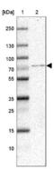SKI Like Proto-Oncogene antibody, NBP1-87020, Novus Biologicals, Western Blot image 
