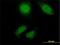 Titin antibody, H00007273-M02, Novus Biologicals, Immunofluorescence image 