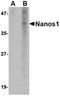 Nanos C2HC-Type Zinc Finger 1 antibody, orb75020, Biorbyt, Western Blot image 