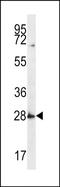 Synaptophysin Like 1 antibody, PA5-48437, Invitrogen Antibodies, Western Blot image 