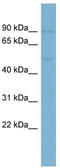 Krox-24 antibody, TA344360, Origene, Western Blot image 