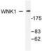 WNK1 antibody, LS-C176254, Lifespan Biosciences, Western Blot image 