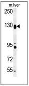 DENN Domain Containing 5B antibody, AP51241PU-N, Origene, Western Blot image 