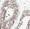 Cilia And Flagella Associated Protein 300 antibody, FNab01008, FineTest, Immunohistochemistry paraffin image 