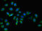 Izumo Sperm-Egg Fusion 1 antibody, orb34424, Biorbyt, Immunocytochemistry image 