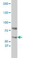 Cryptochrome Circadian Regulator 1 antibody, LS-B5393, Lifespan Biosciences, Western Blot image 