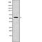CALCRL antibody, abx148828, Abbexa, Western Blot image 