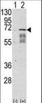 Activin A Receptor Type 1 antibody, LS-B11761, Lifespan Biosciences, Western Blot image 