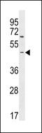 Rho Guanine Nucleotide Exchange Factor 35 antibody, LS-C159111, Lifespan Biosciences, Western Blot image 