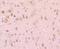 Plasminogen Activator, Tissue Type antibody, A02965, Boster Biological Technology, Immunohistochemistry paraffin image 