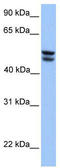 3-Oxoacid CoA-Transferase 1 antibody, TA346673, Origene, Western Blot image 