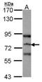 Ras guanyl-releasing protein 3 antibody, NBP1-31501, Novus Biologicals, Western Blot image 