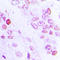 CCAAT Enhancer Binding Protein Beta antibody, LS-C351985, Lifespan Biosciences, Immunohistochemistry paraffin image 