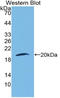 Laminin subunit beta-3 antibody, LS-C314886, Lifespan Biosciences, Western Blot image 