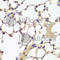 Estrogen Receptor 2 antibody, A2546, ABclonal Technology, Immunohistochemistry paraffin image 