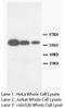 Matrix Metallopeptidase 16 antibody, orb18099, Biorbyt, Western Blot image 