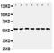 Cytochrome P450 Family 11 Subfamily B Member 1 antibody, PA1699, Boster Biological Technology, Western Blot image 
