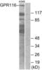 Probable G-protein coupled receptor 116 antibody, LS-B9443, Lifespan Biosciences, Western Blot image 