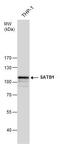 DNA-binding protein SATB1 antibody, PA5-30163, Invitrogen Antibodies, Western Blot image 