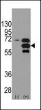 Internexin Neuronal Intermediate Filament Protein Alpha antibody, LS-C100003, Lifespan Biosciences, Western Blot image 