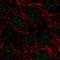 Serine And Arginine Rich Splicing Factor 5 antibody, HPA056523, Atlas Antibodies, Immunocytochemistry image 