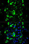 Granzyme B antibody, STJ26211, St John