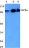 Unc-5 Netrin Receptor A antibody, A07537, Boster Biological Technology, Western Blot image 