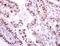 NIMA Related Kinase 2 antibody, NBP2-19510, Novus Biologicals, Immunohistochemistry paraffin image 