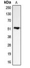 Bone Morphogenetic Protein 5 antibody, LS-B14557, Lifespan Biosciences, Western Blot image 