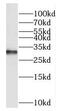Exosome complex exonuclease RRP40 antibody, FNab02903, FineTest, Western Blot image 