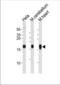 NADH:Ubiquinone Oxidoreductase Core Subunit S7 antibody, TA325031, Origene, Western Blot image 