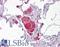 Vav Guanine Nucleotide Exchange Factor 2 antibody, LS-B6444, Lifespan Biosciences, Immunohistochemistry paraffin image 