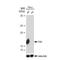 Mitochondrial fission 1 protein antibody, GTX00950, GeneTex, Western Blot image 