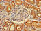 CEP215 antibody, LS-C677467, Lifespan Biosciences, Immunohistochemistry paraffin image 
