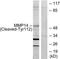 Matrix Metallopeptidase 14 antibody, TA312181, Origene, Western Blot image 