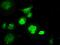 LEM Domain Containing 3 antibody, MA5-25021, Invitrogen Antibodies, Immunocytochemistry image 