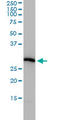 Proteasome subunit alpha type-4 antibody, LS-C198016, Lifespan Biosciences, Western Blot image 