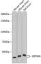 Zinc Finger And BTB Domain Containing 38 antibody, 22-266, ProSci, Western Blot image 