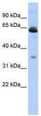 Translocase Of Outer Mitochondrial Membrane 40 Like antibody, TA338719, Origene, Western Blot image 