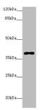 DNA Polymerase Beta antibody, A63170-100, Epigentek, Western Blot image 