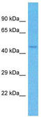 Zinc Finger Protein 772 antibody, TA330838, Origene, Western Blot image 