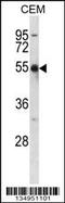 Potassium Voltage-Gated Channel Subfamily A Member 2 antibody, 57-959, ProSci, Western Blot image 